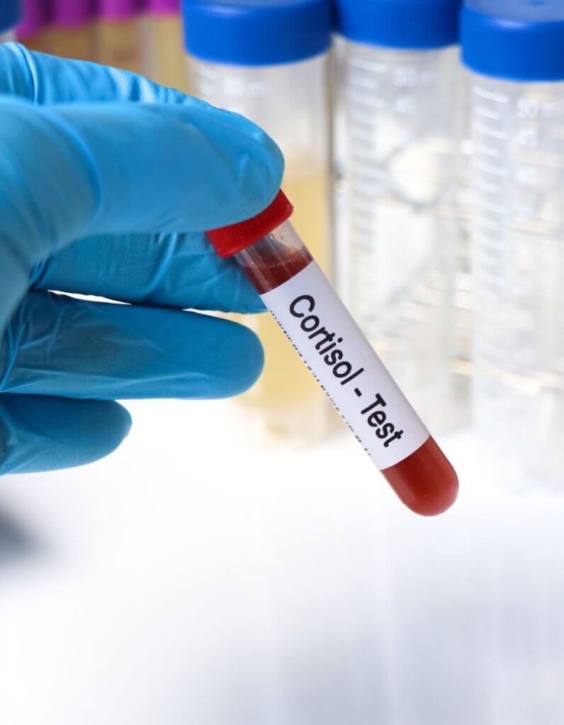 Cortisol energy fat loss brain health